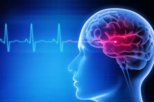Medzinárodné uznanie pre tím z Neurochirurgickej kliniky UNB